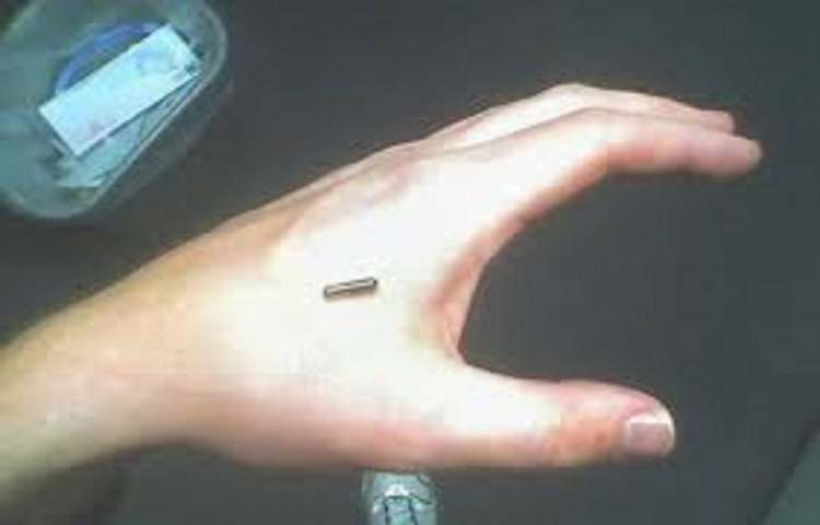 Microchips en humanos ,¿Es bueno?  O, ¿Viola la intimidad?