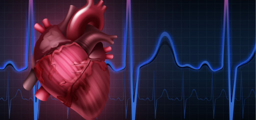 Inteligencia artificial para predecir un paro cardíaco