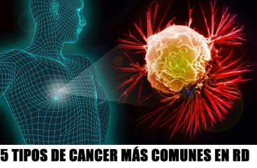 ESTOS SON LOS 5 TIPOS DE CANCER MÁS COMUNES EN REPÚBLICA DOMINICANA