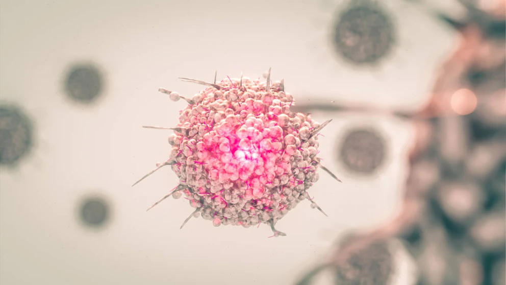 El Día Mundial del Cáncer de Mama 2023